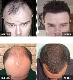 Before and after results