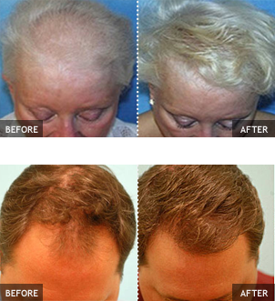 Before and after results