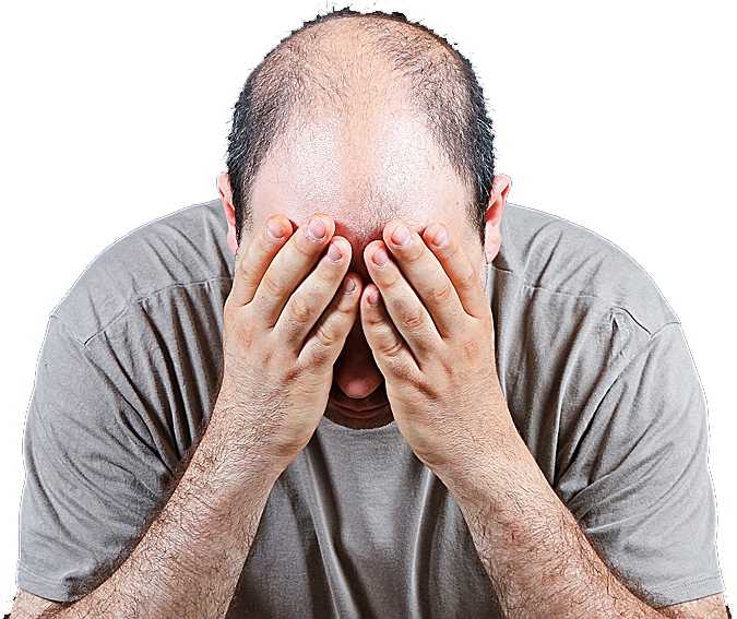 Man frustrated with hair loss