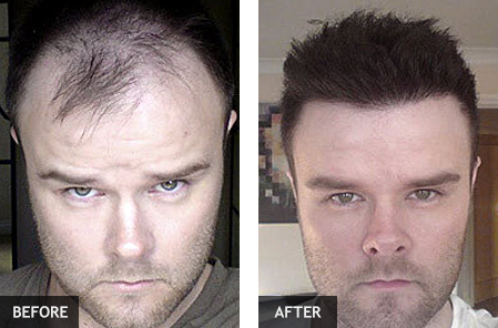 Customer before and after photo